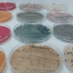 Photograph of agar plates that are used to detect antimicrobial resistance