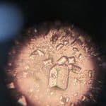 Photograph of triple phosphate crystals in urine
