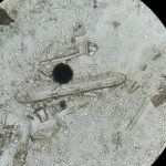 An image taken using a microscope lens of algae.