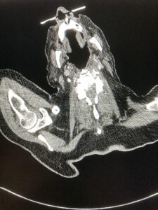 A computed tomography (CT) slice of someone's neck...and glasses. 