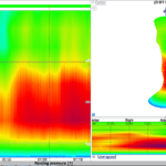 An image of 3D model built from measuring the rectum