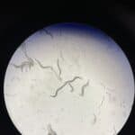 Picture of the worm C. elegans when looking down the microscope